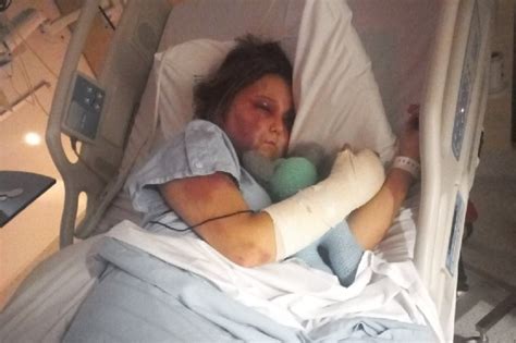 kirra heart after attack|Queensland crime: Teenage girls charged over brutal。